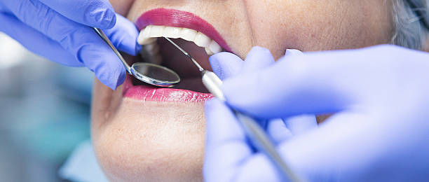 Best Emergency Dental Care for Broken or Chipped Teeth in Orangevale, CA